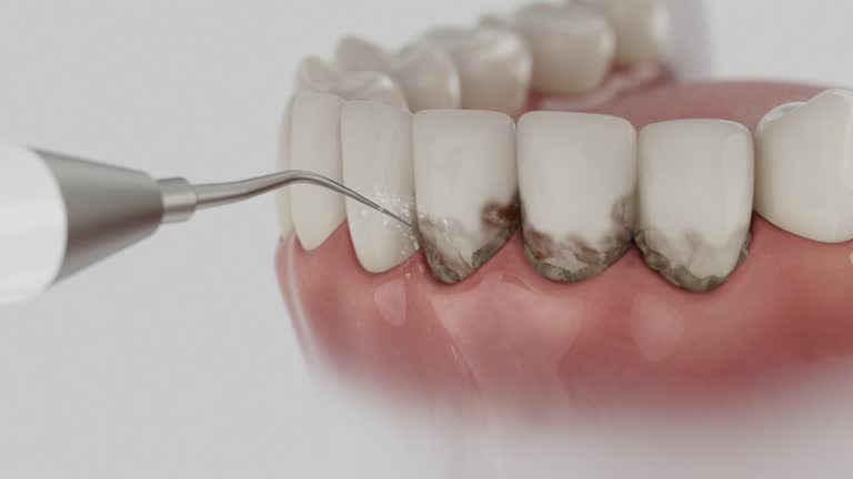 Trusted Teeth Whitening service in Leland, NC - Dentist Open Now